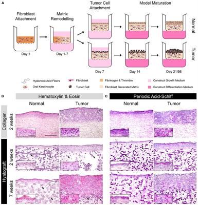 Primary Extracellular Matrix Enables Long-Term Cultivation of Human Tumor Oral Mucosa Models